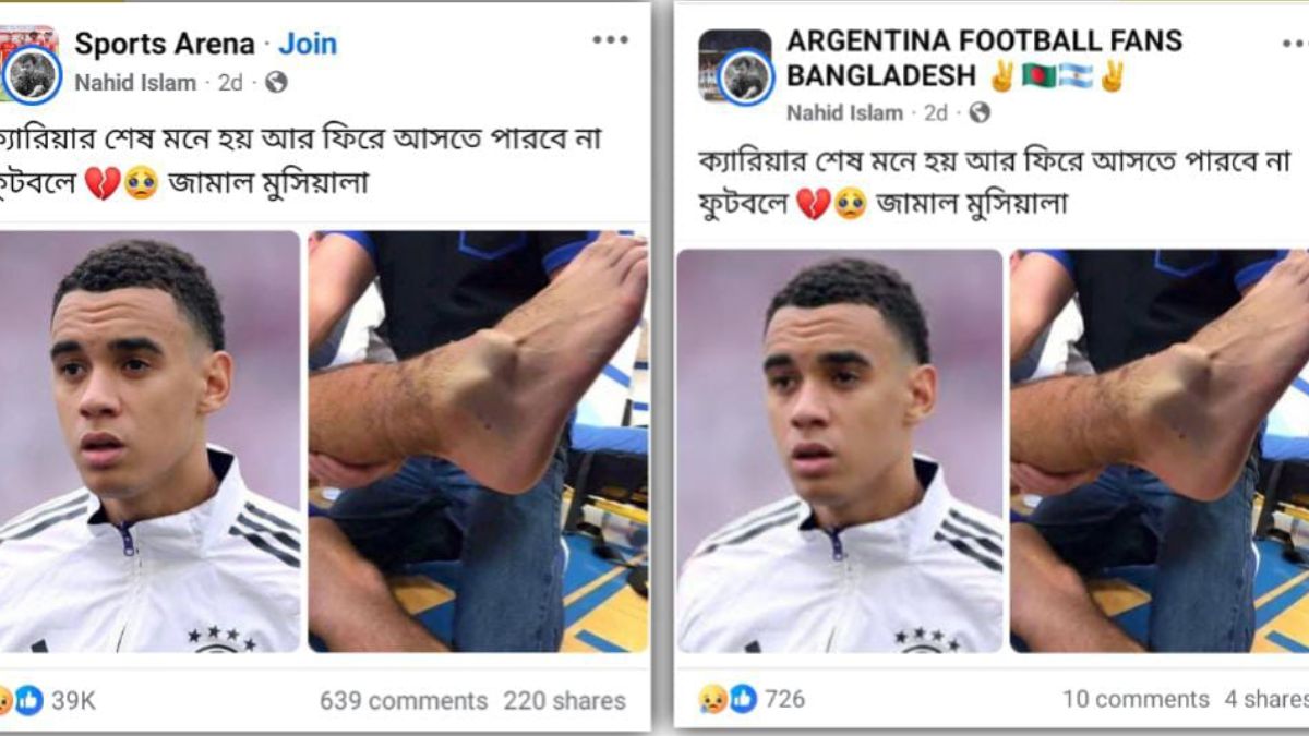 Fact Check: That’s Not Musiala’s Foot: False Image Circulating After Injury
