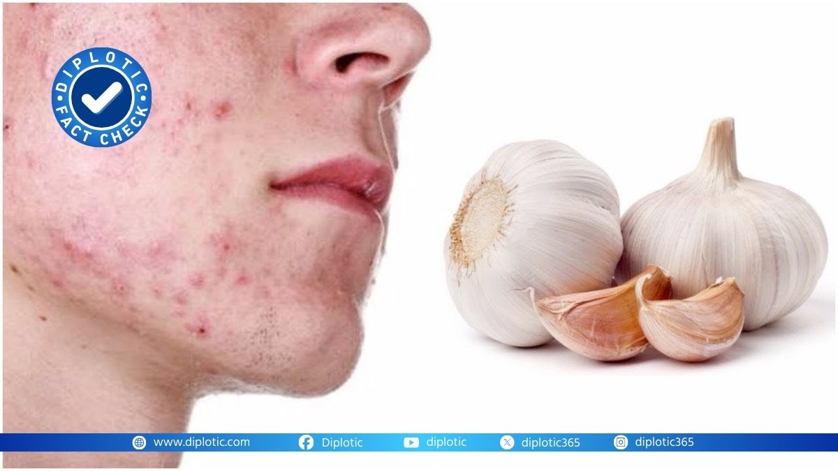 Fact Check: You can remove pimples by scratching garlic on your face